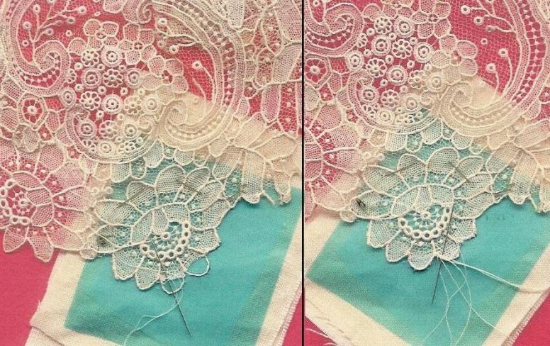 restauration_dentelle